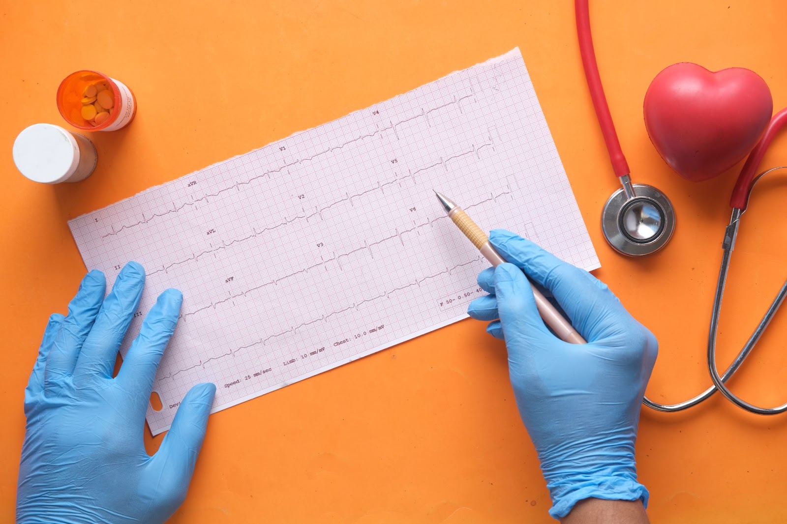 exercise ecg 