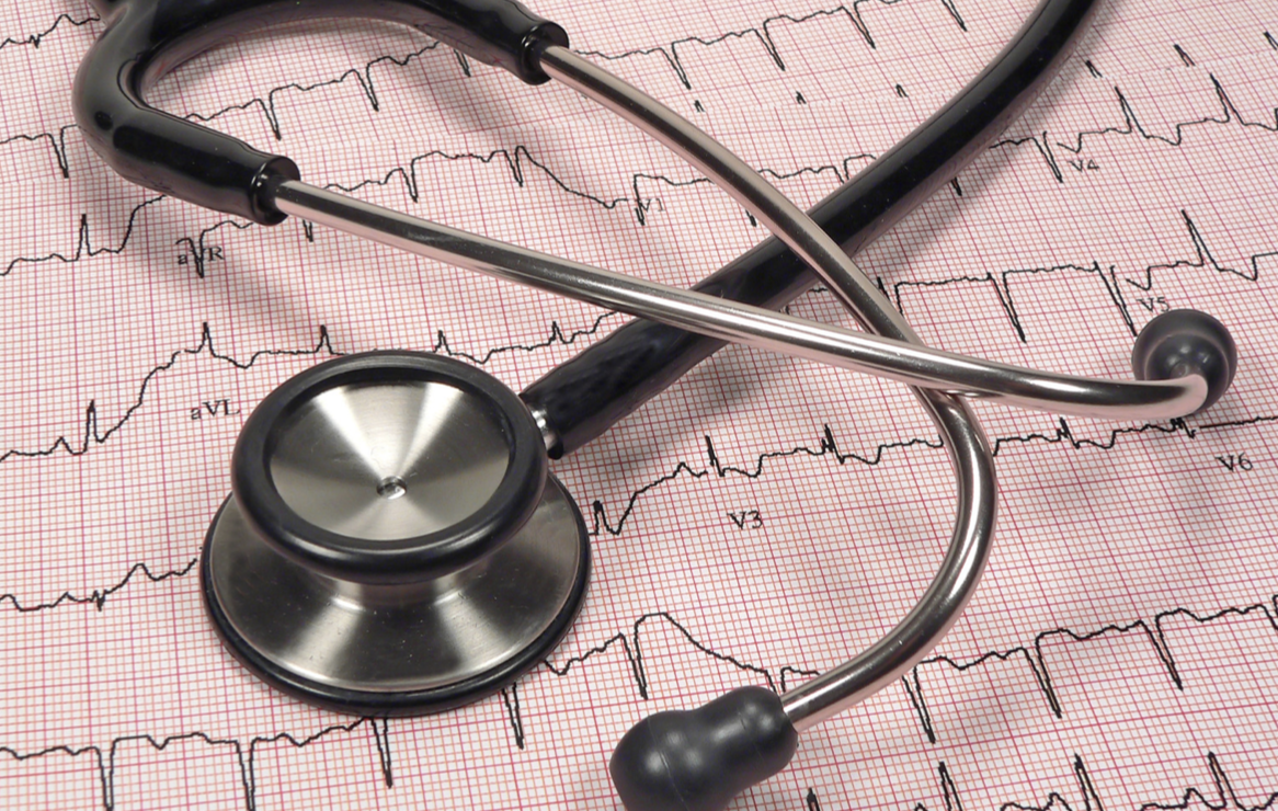 cardiac arrhythmia and sport