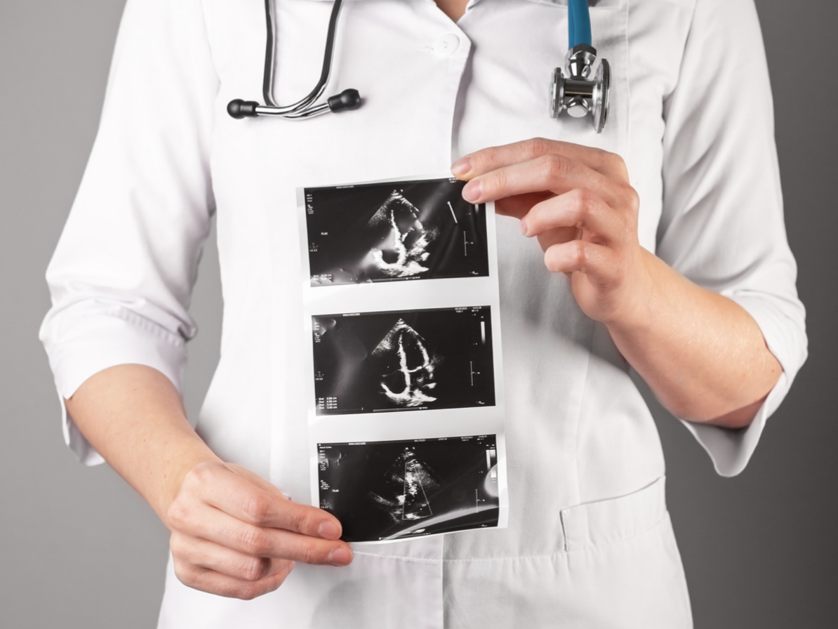 arythmie cardiaque enceinte