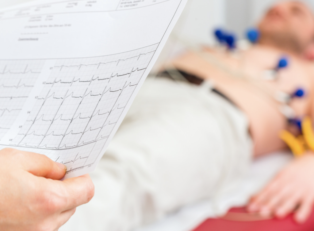 electrocardiogramme