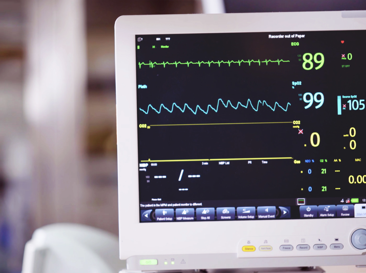 electrocardiogramme