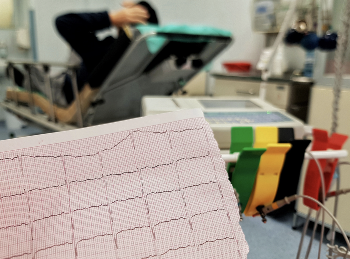 electrocardiogramme