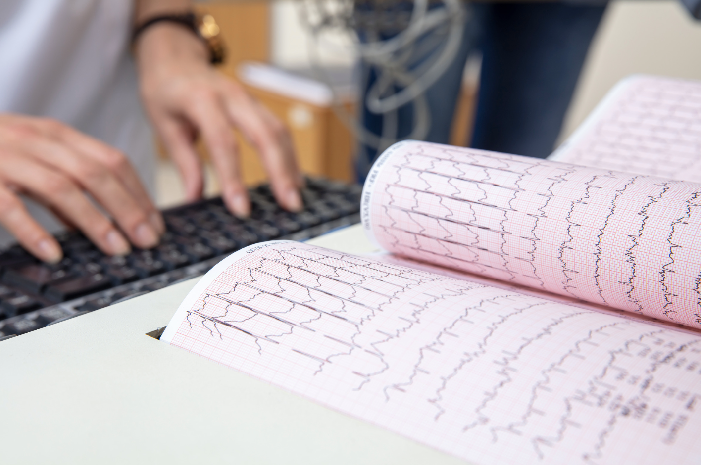 resting electrocardiogram