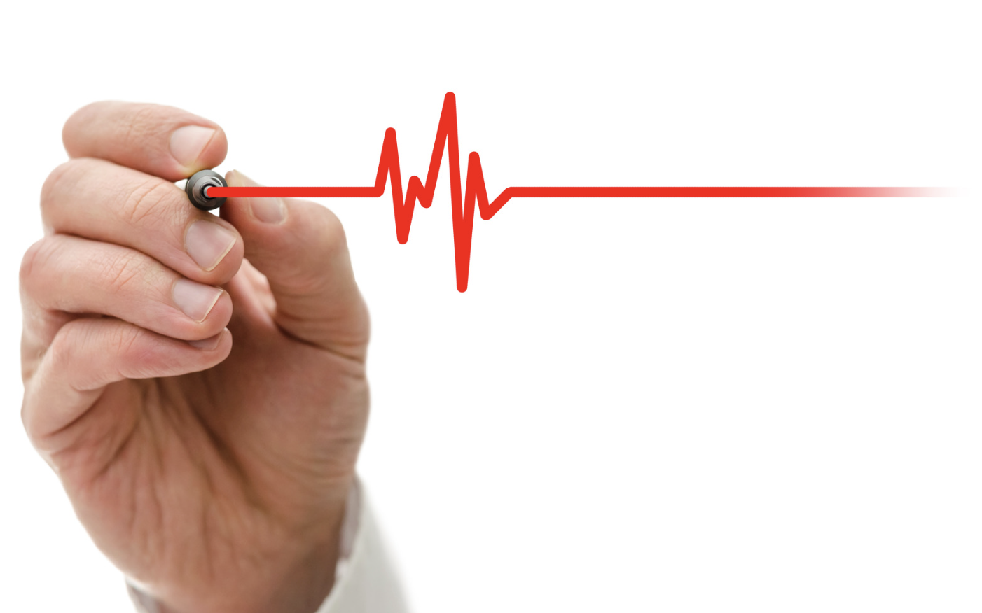 Cardiac monitoring
