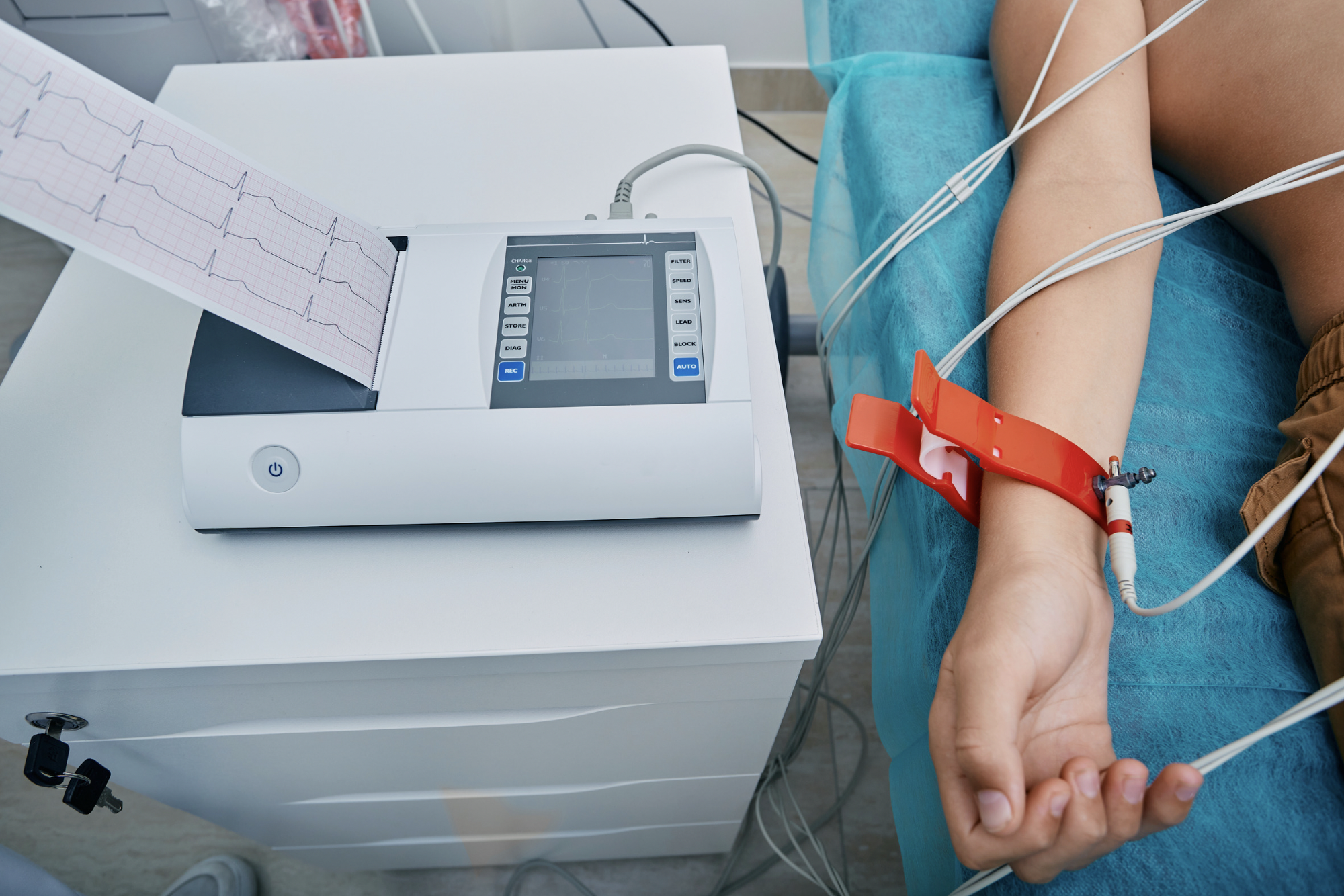 ecg au repos