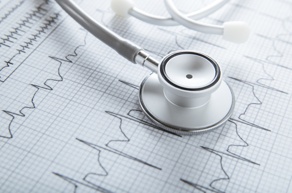ecg au repos