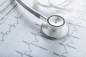 ecg at rest