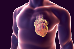 cardiac stroke